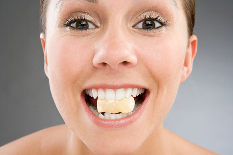 Why are Pop On Veneers worth buying and wearing?