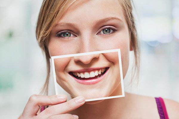 Snap-On Veneers: Usage and Frequently Asked Questions