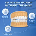 Both Veneers