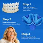 Either Top or Bottom Veneers