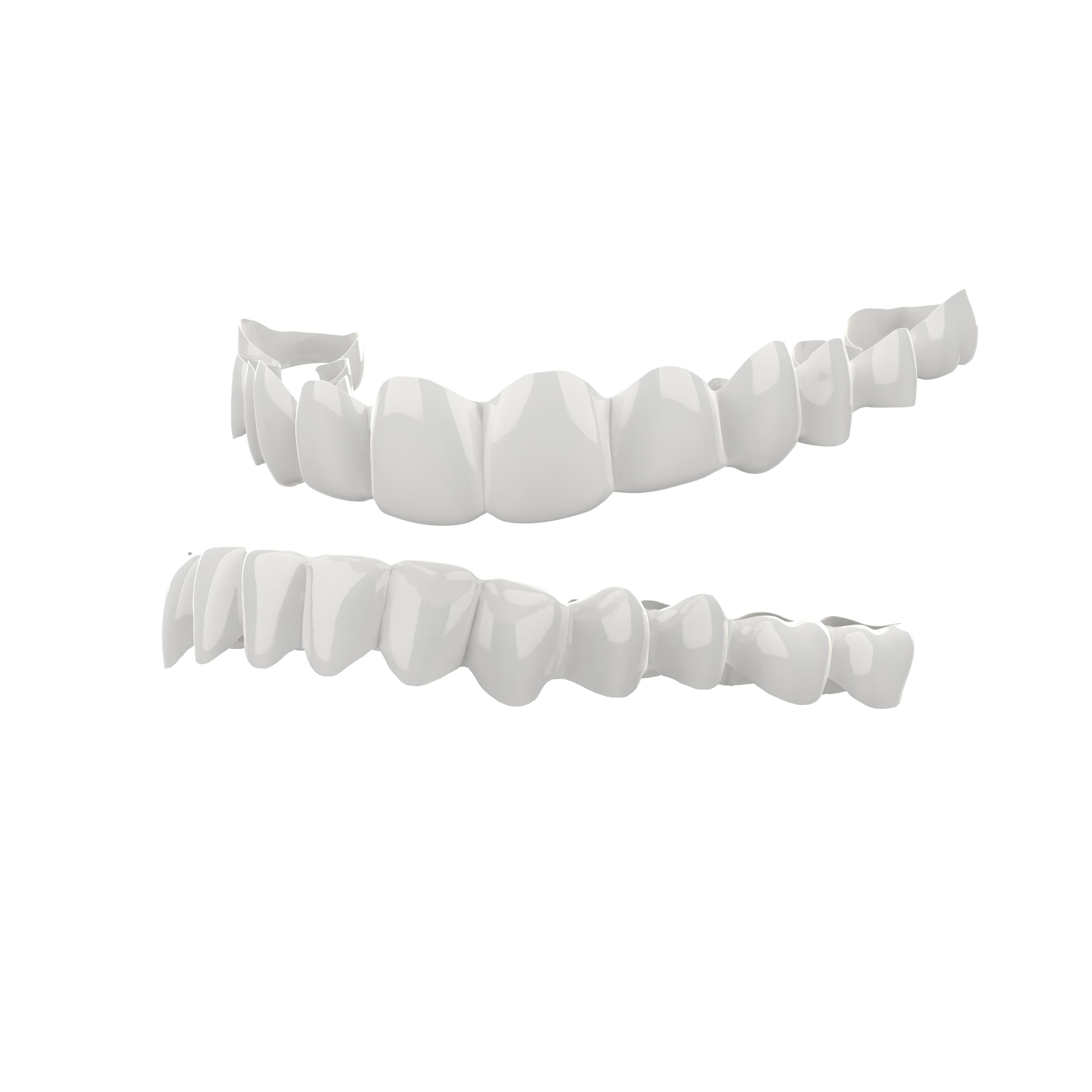 Custom Teeth Whitening Veneers – Custom Fit Smile