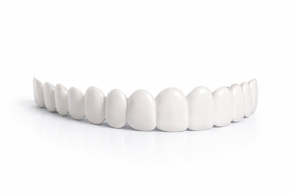 Either Top or Bottom Veneers