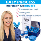 Either Top or Bottom Veneers