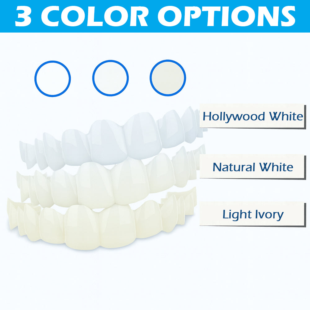 Either Top or Bottom Veneers