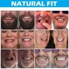 Either Top or Bottom Veneers